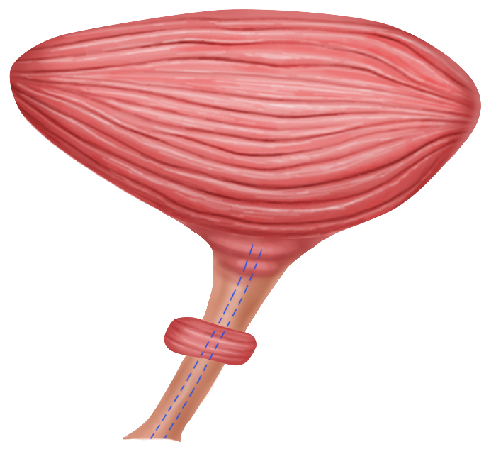 Anatomia dell'uretra - Fig. 1